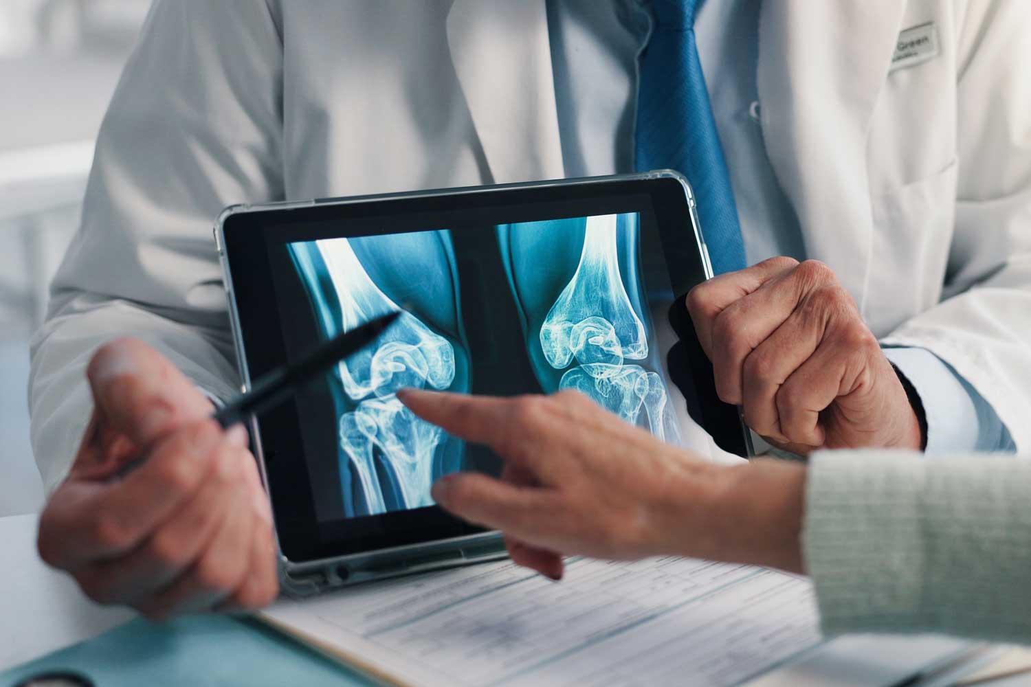Ayurveda in knee osteoarthritis: clinical and research perspective